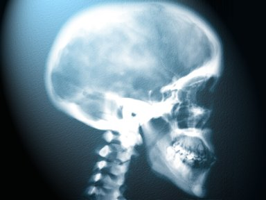 With all the recent, wonderful advances in medical technology, nothing!
