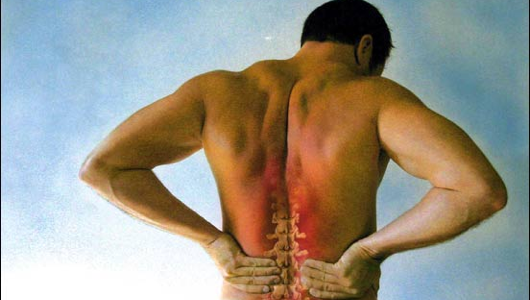 Actual picture of my back. Note how my spine is trying to escape my body.